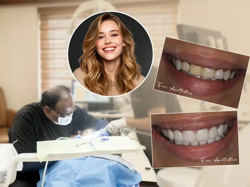 Smile Makeover Cost in Hyderabad, India