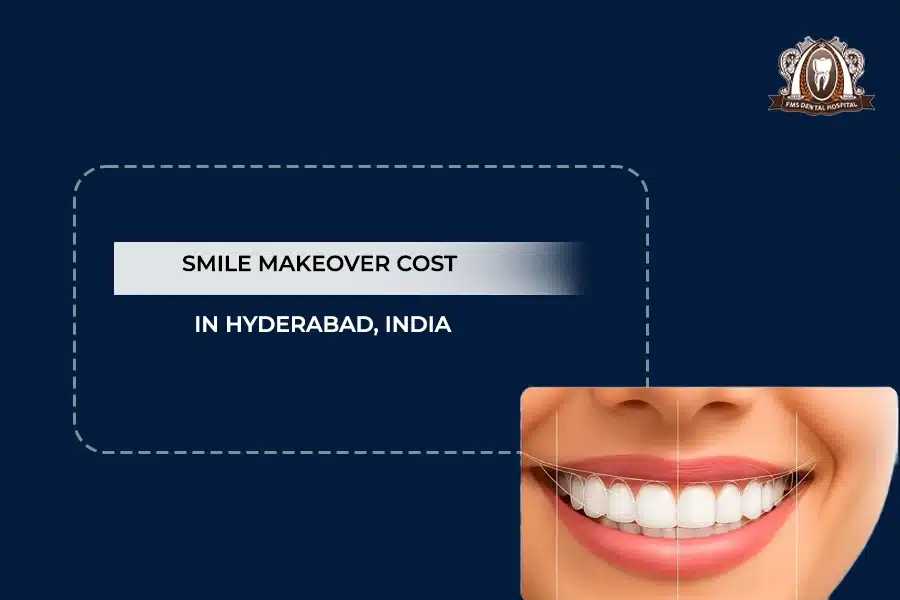 smile makeover