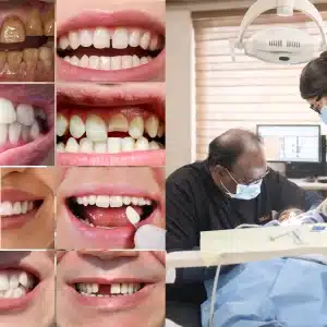 When Do You Need a Cosmetic Dentist in Hyderabad? (10 Signs You Shouldn’t Ignore)