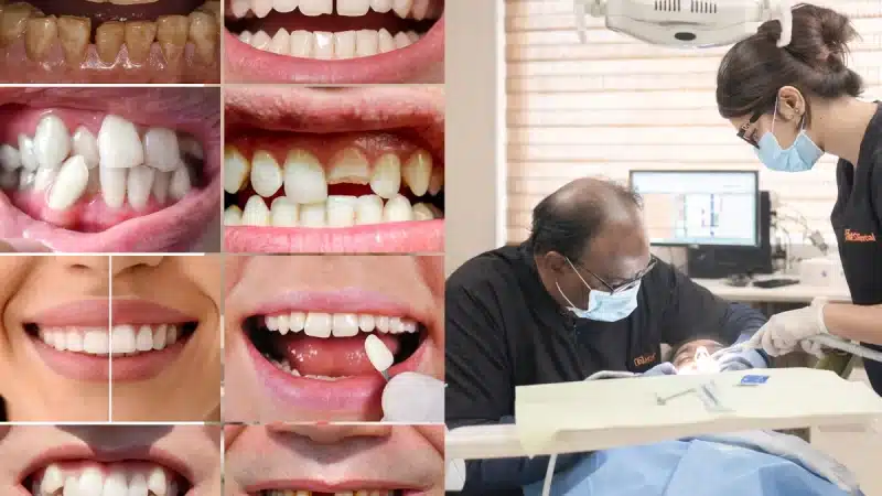 When Do You Need a Cosmetic Dentist in Hyderabad? (10 Signs You Shouldn’t Ignore)