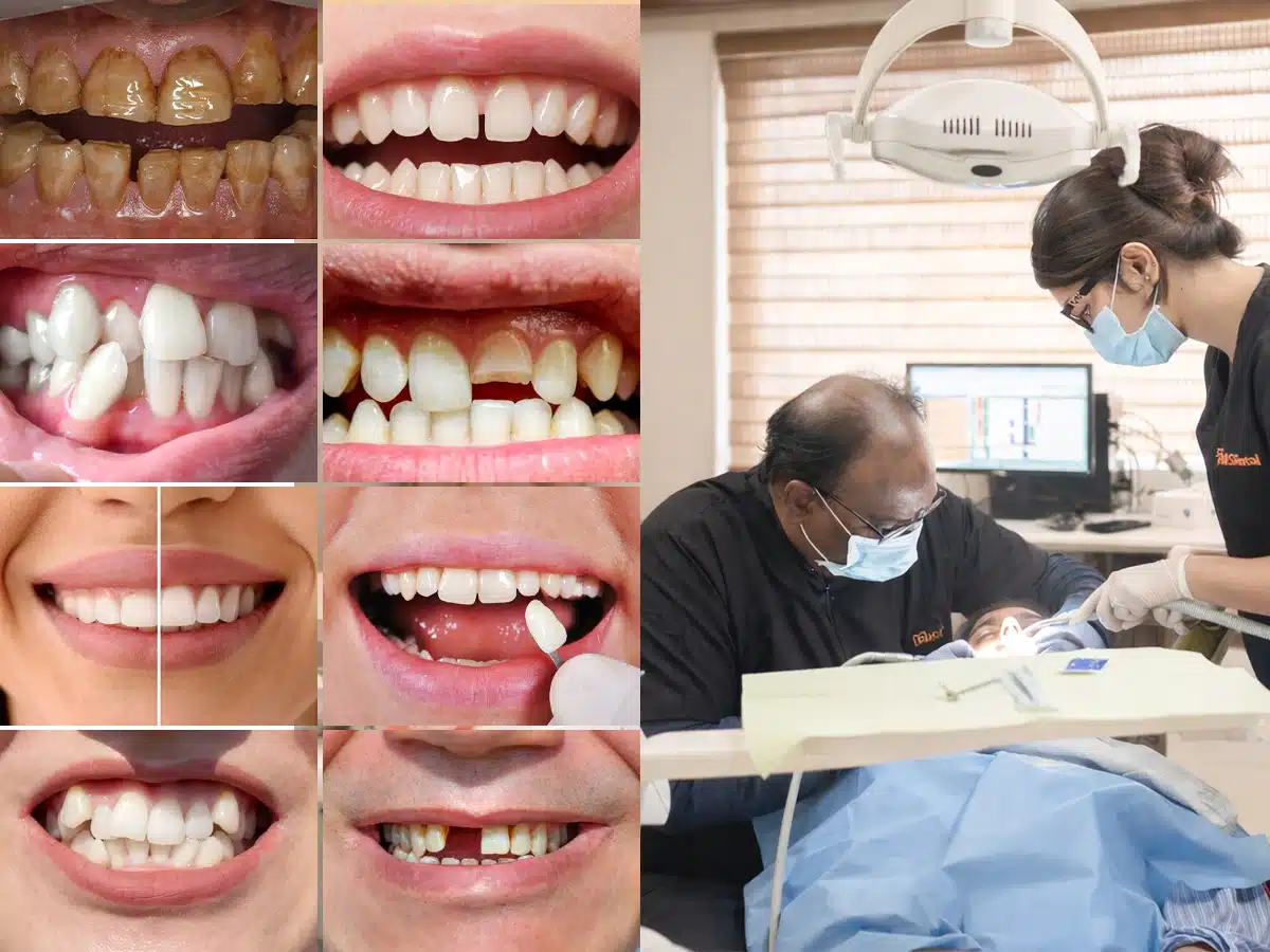 When Do You Need a Cosmetic Dentist in Hyderabad? (10 Signs You Shouldn’t Ignore)