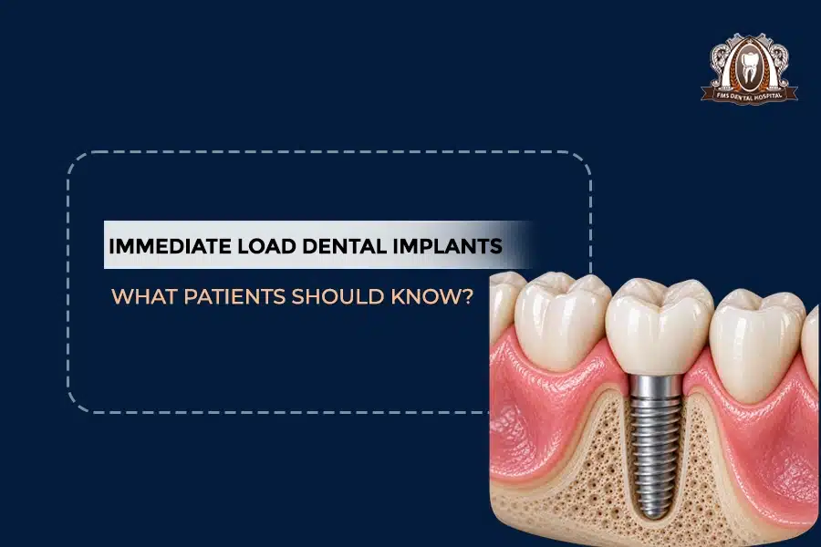 IMPLANT LOAD