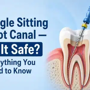 Single Sitting Root Canal — Is It Safe? Everything You Need to Know