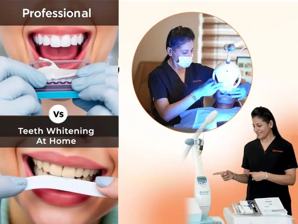 Teeth Whitening Cost & Treatment Comparison