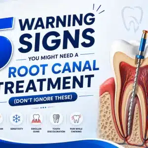 5 Warning Signs You Might Need a Root Canal Treatment (Don’t Ignore These)