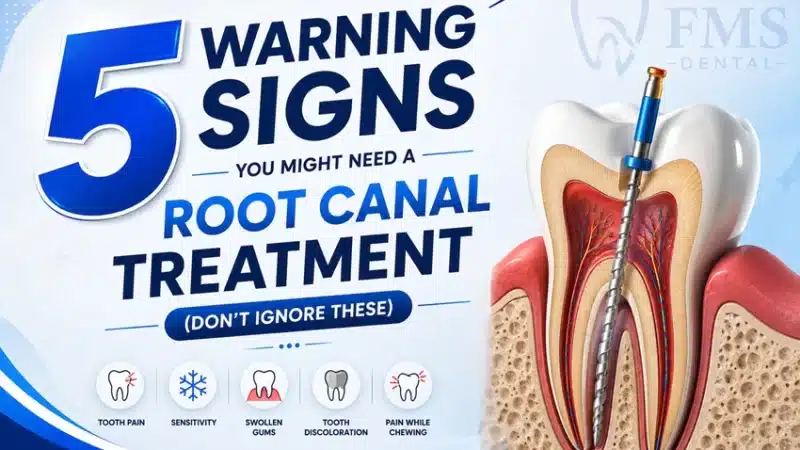 5 Warning Signs You Might Need a Root Canal Treatment (Don’t Ignore These)