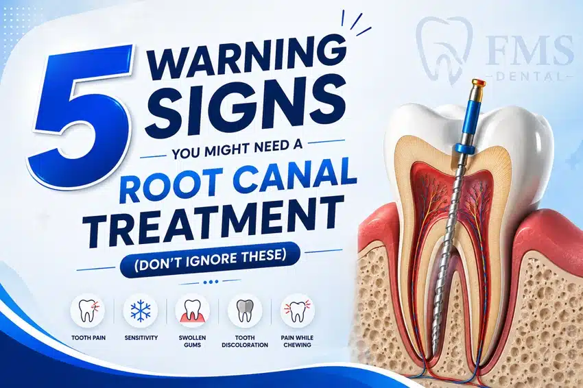 5 Warning Signs You Might Need a Root Canal Treatment (Don’t Ignore These)
