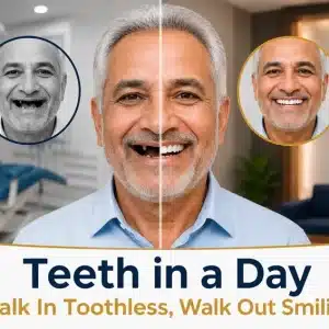 Teeth in a Day