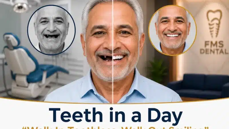 Teeth in a Day