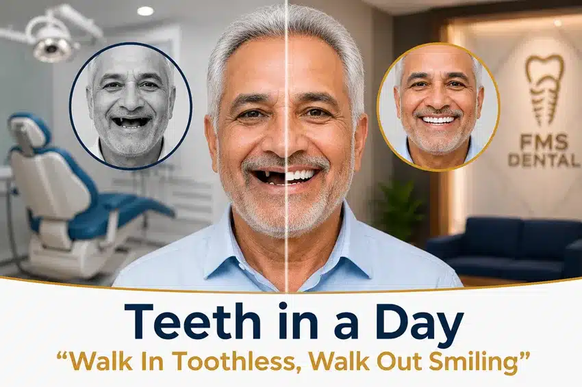 Teeth in a Day