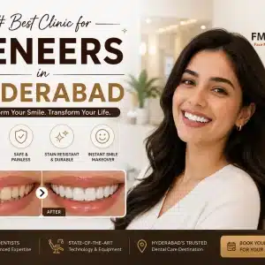 Best Clinic for Veneers in Hyderabad