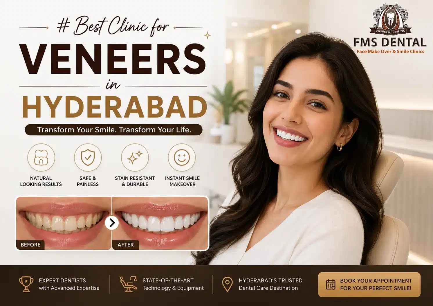 Best Clinic for Veneers in Hyderabad