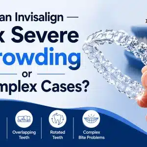Can Invisalign Fix Severe Crowding or Complex Cases?