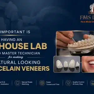 How important is having an in-house lab and master technician for making natural looking porcelain veneers