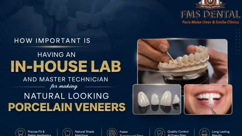How important is having an in-house lab and master technician for making natural looking porcelain veneers