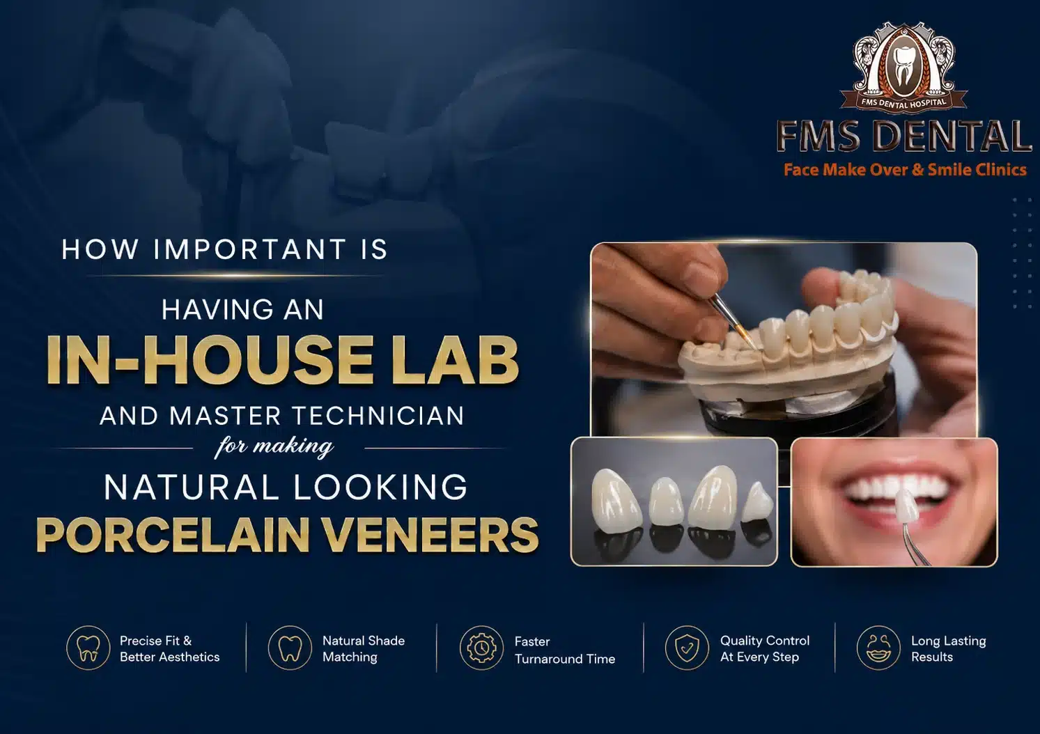 How important is having an in-house lab and master technician for making natural looking porcelain veneers