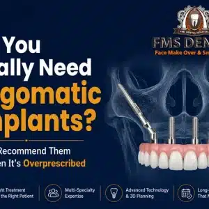 Do You Really Need Zygomatic Implants? When Recommend Them vs When It’s Overprescribed