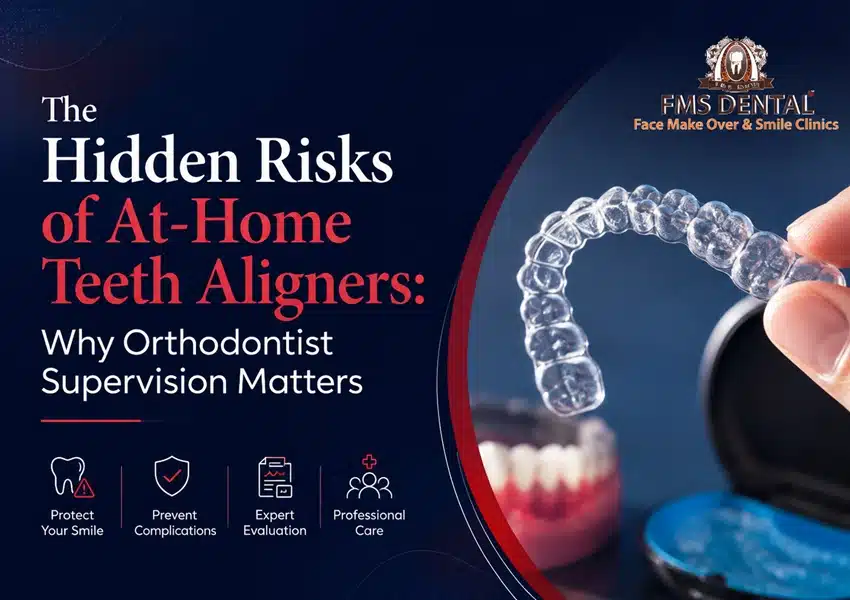 The Hidden Risks of At-Home Teeth Aligners: Why Orthodontist Supervision Matters