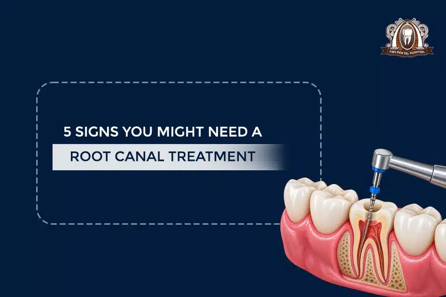 5 signs root-canal