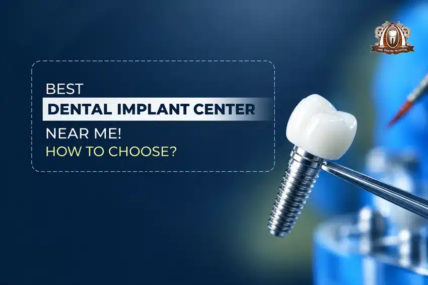 BEST DENTAL IMPLANT CENTER NEAR ME! HOW TO CHOOSE