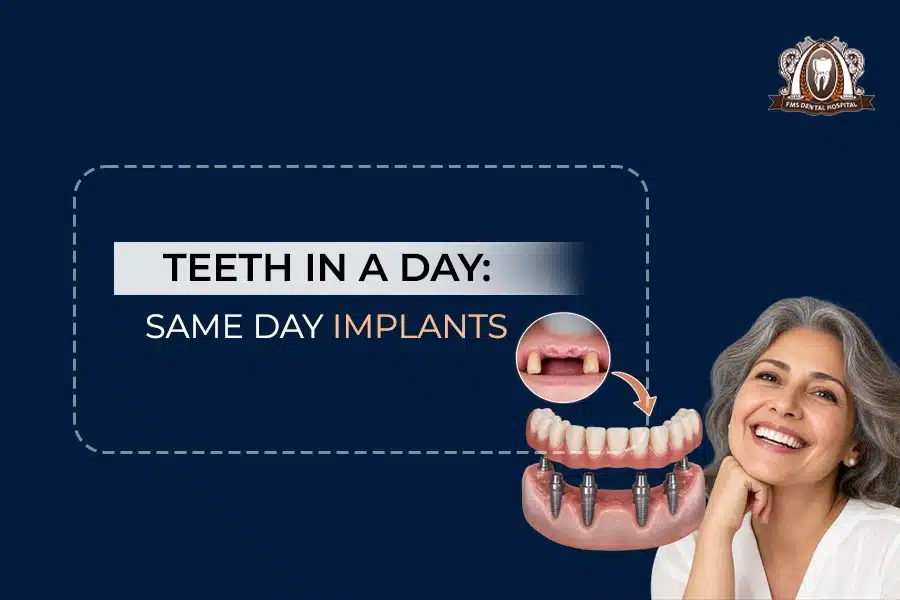 TEETH IN A DAY
