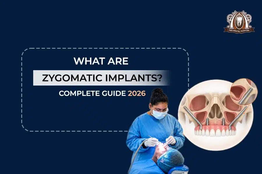 zygomatic-implants