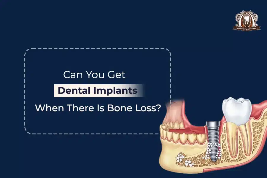 Can you get dental implants Blog image
