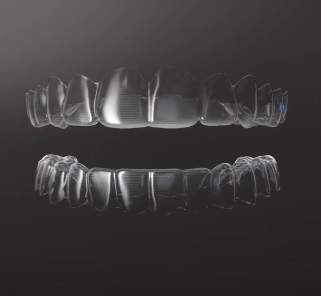 Clear Aligners Treatment Cost In Hyderabad India At FMS Dental