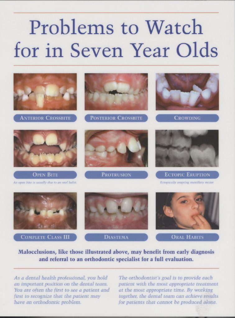 braces treatment in hyderabad
