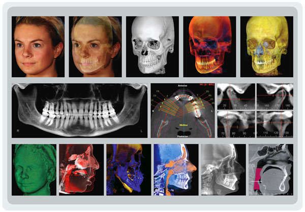 cbct orthognathic surgery plan