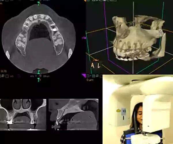 CBCT Guided Endondontics