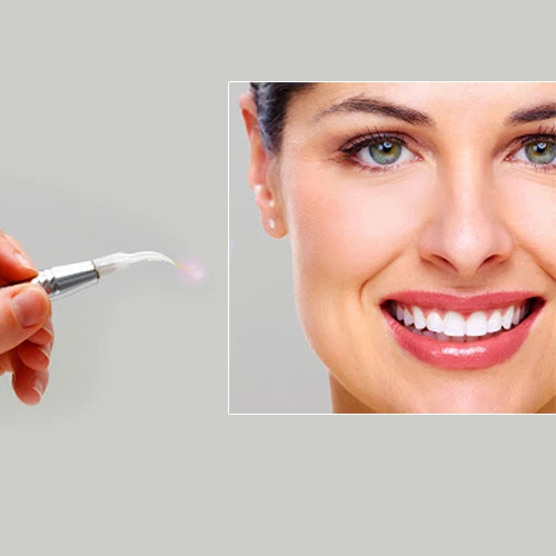 laser root canal treatment