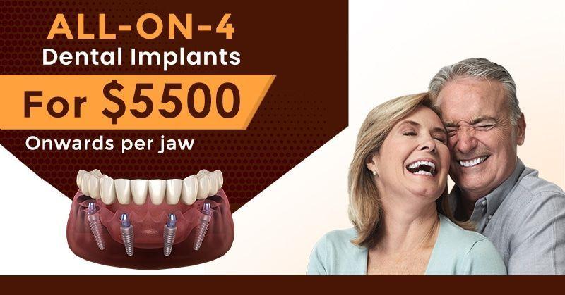 best affordable all-on-4 dental implants