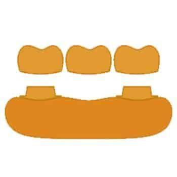 dental-crowns-&-bridges