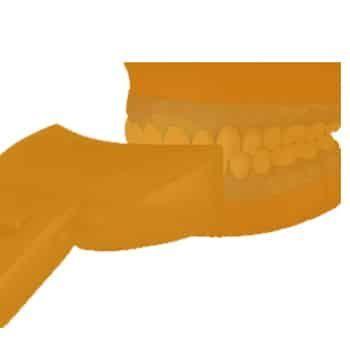 zoom-teeth-whitening