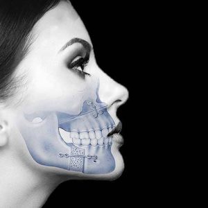 Orthognathic jaw correction in Hyderabad India