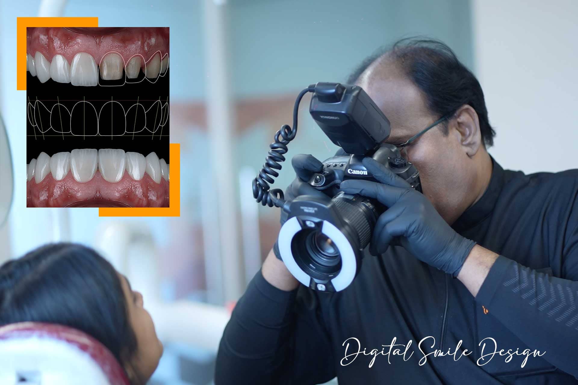 What Is Smile Design