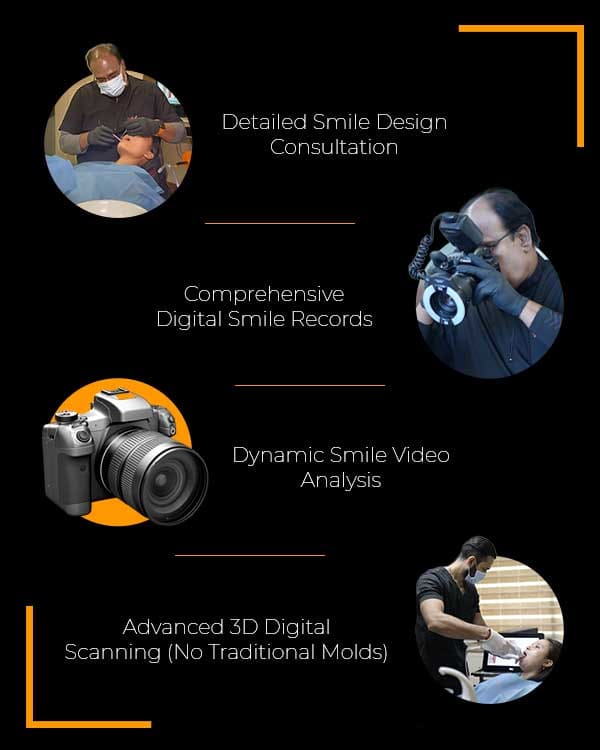 Smile Model R702 Best Smile Design Clinic in Hyderabad, India - FMS Dental