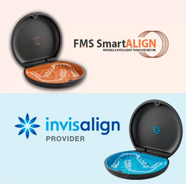 Clear aligners for teeth straightening