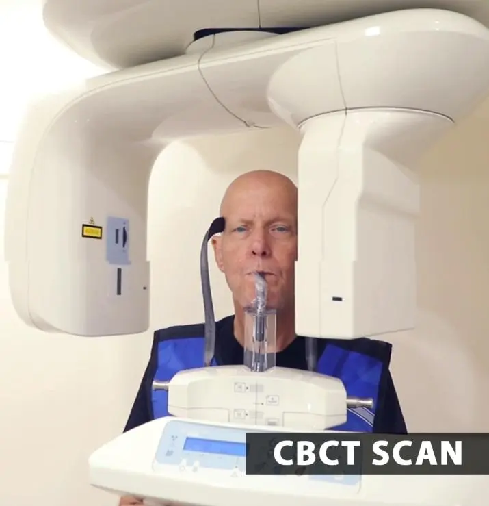 Full-Skull 3D Cone Beam CT (CBCT)