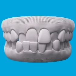 Crossbite