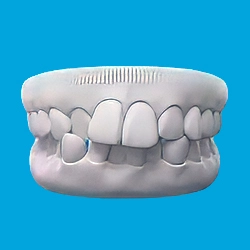Crowded Teeth