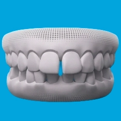 Spaced Teeth & Gaps