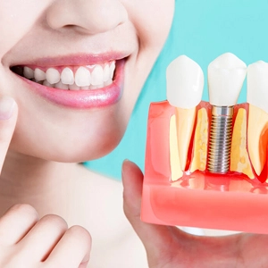 Immediate Loading — Same-Day Teeth