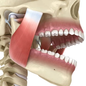 Jaw Locking (Trismus)