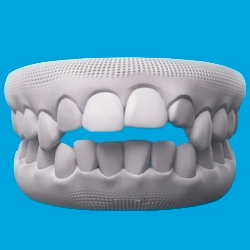 Open Bite