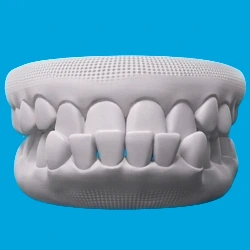 Underbite