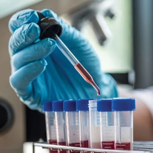 Blood Examination & Nutrition