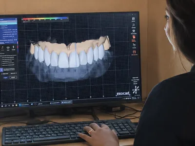 Digital Smile Design (DSD)
