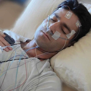 Polysomnography (Sleep Study)